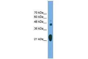 WB Suggested Anti-RAB37 Antibody Titration: 0. (RAB37 anticorps  (Middle Region))