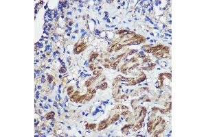 Immunohistochemistry of paraffin-embedded Rat lung using SND1 Rabbit pAb (ABIN6129741, ABIN6148197, ABIN6148199 and ABIN6221577) at dilution of 1:100 (40x lens).