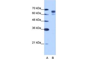 Western Blotting (WB) image for anti-DEAD (Asp-Glu-Ala-Asp) Box Polypeptide 17 (DDX17) antibody (ABIN2462307) (DDX17 anticorps)