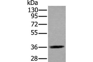 Western blot analysis of Jurkat cell lysate using ACAT2 Polyclonal Antibody at dilution of 1:550 (ACAT2 anticorps)