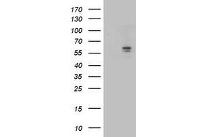 Western Blotting (WB) image for anti-Aldehyde Dehydrogenase 3 Family, Member A2 (ALDH3A2) antibody (ABIN1496594) (ALDH3A2 anticorps)
