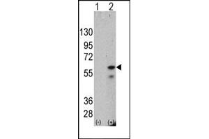 Western Blotting (WB) image for anti-PTEN Induced Putative Kinase 1 (PINK1) antibody (ABIN356392) (PINK1 anticorps)