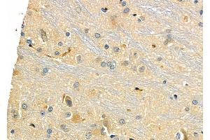 ABIN6258972 and ABIN6275963 at 1/100 staining Rat brain tissue by IHC-P. (GPR173 anticorps  (Internal Region))
