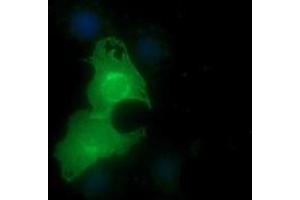 Image no. 1 for anti-Epithelial Cell Adhesion Molecule (EPCAM) antibody (ABIN1498119) (EpCAM anticorps)