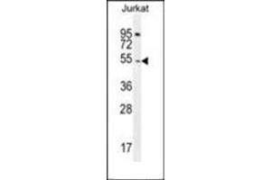 Western blot analysis of DARS1 Antibody (N-term) in Jurkat cell line lysates (35ug/lane). (DARS anticorps  (N-Term))