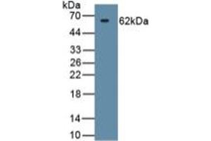 WB of Protein Standard: different control antibodies against Highly purified E. (HSPD1 Kit ELISA)