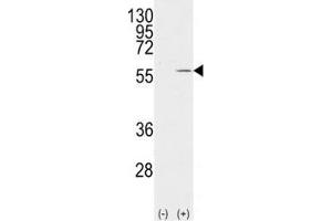 Western blot analysis of Vimentin antibody and 293 cell lysate (2 ug/lane) either nontransfected (Lane 1) or transiently transfected with the VIM gene (2). (Vimentin anticorps  (AA 63-90))