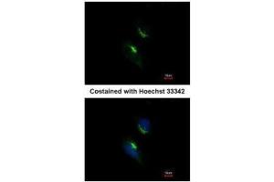 ICC/IF Image Immunofluorescence analysis of methanol-fixed HeLa, using PRPS1, antibody at 1:200 dilution. (PRPS1 anticorps)