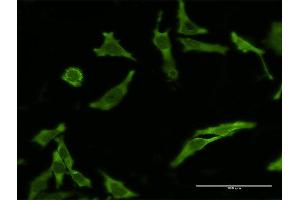 Immunofluorescence of monoclonal antibody to CFLAR on HeLa cell.