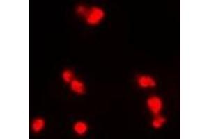 Immunofluorescent analysis of INI1 staining in MCF7 cells. (SMARCB1 anticorps)