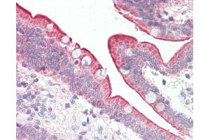 Human Small Intestine: Formalin-Fixed, Paraffin-Embedded (FFPE). (Scramblase anticorps  (AA 121-170))