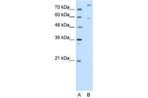 CROT antibody used at 2. (CROT anticorps  (N-Term))