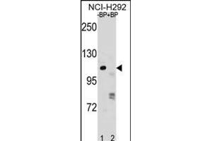 RP1 Antibody (N-term) (ABIN1881627 and ABIN2838811) pre-incubated without(lane 1) and with(lane 2) blocking peptide in NCI- cell line lysate. (PARP1 anticorps  (N-Term))