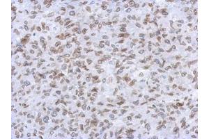 IHC-P Image Immunohistochemical analysis of paraffin-embedded RT2 xenograft, using Lamin A + C, antibody at 1:500 dilution. (Lamin A/C anticorps)