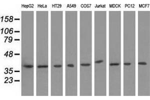 Western blot analysis of extracts (35 µg) from 9 different cell lines by using anti-HIBCH monoclonal antibody.