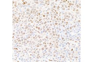Immunohistochemistry (IHC) image for anti-Tumor Protein P53 Binding Protein 1 (TP53BP1) (AA 350-400) antibody (ABIN7453568) (TP53BP1 anticorps  (AA 350-400))