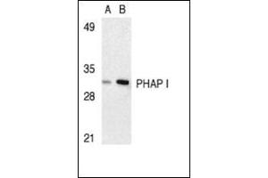 Western blot analysis of PHAP I expression in human Raji cell lysate with AP30663PU-N I at 2 μg/ml (lane A) and 4 μg/ml (lane B), respectively. (PHAP1 anticorps  (C-Term))