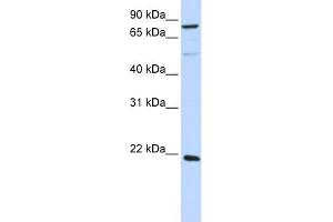 WB Suggested Anti-ARL11 Antibody Titration: 0.