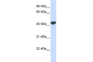 WB Suggested Anti-ZRANB2 Antibody Titration:  0. (ZNF265 anticorps  (N-Term))