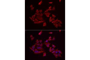 Immunofluorescence analysis of MCF-7 cells using RARRES2 antibody (ABIN5974187). (Chemerin anticorps)