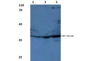 Western blot(WB) analysis of p-IkB-α antibody (NFKBIA anticorps  (pTyr42))