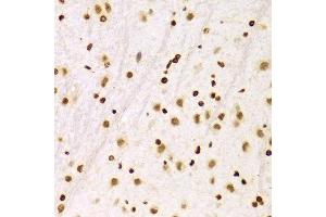 Immunohistochemistry of paraffin-embedded Rat brain using Histone H3 antibody at dilution of 1:100 (x400 lens). (Histone 3 anticorps  (C-Term))