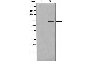 Western blot analysis on COLO205 cell lysate using TF2H2 Antibody,The lane on the left is treated with the antigen-specific peptide. (GTF2H2 anticorps  (N-Term))