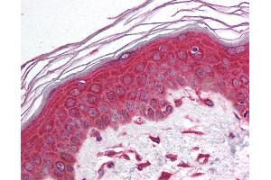 Anti-IKB Alpha antibody IHC of human skin.