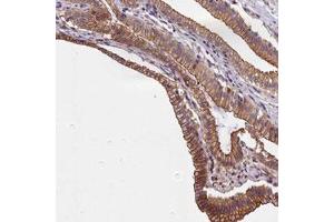 Immunohistochemical staining (Formalin-fixed paraffin-embedded sections) of human gall bladder with BLACE polyclonal antibody  shows distinct cytoplasmic and membranous positivity in glandular cells. (BLACE anticorps)