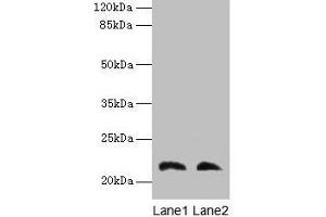 Western blot All lanes: LGALS9C antibody at 4 μg/mL Lane 1: Mouse stomach tissue Lane 2: Mouse liver tissue Secondary Goat polyclonal to rabbit IgG at 1/10000 dilution Predicted band size: 40 kDa Observed band size: 22 kDa (LGALS9C anticorps  (AA 1-356))