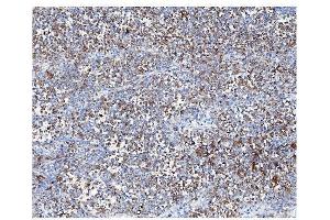 IHC analysis of ARF6 using anti-ARF6 antibody (ABIN4886473). (ARF6 anticorps  (AA 2-175))