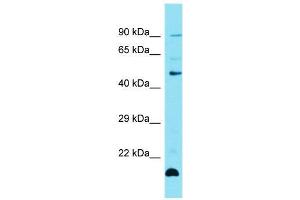 Host:  Rabbit  Target Name:  Zfp27  Sample Type:  Mouse Thymus lysates  Antibody Dilution:  1. (Zinc Finger Protein 27 (ZFP27) (Middle Region) anticorps)
