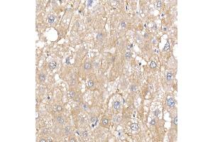 Immunohistochemistry of paraffin-embedded human liver using IQG Rabbit mAb (ABIN7268021) at dilution of 1:25 (40x lens). (IQGAP2 anticorps)