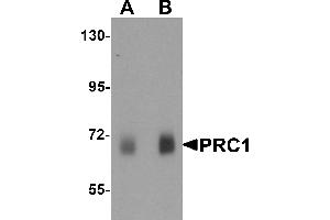 Western blot analysis of PRC1 in human skeletal muscle tissue lysate with Prc1 antibody at (A) 0. (PRC1 anticorps  (Middle Region))