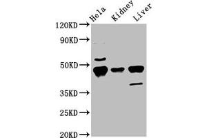 Western Blot Positive WB detected in: Hela whole cell lysate, Mouse kidney tissue, Mouse liver tissue All lanes: Krt18 antibody at 5.