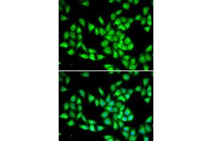 Immunofluorescence analysis of HeLa cells using PCMT1 antibody. (PCMT1 anticorps)