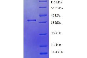 SDS-PAGE (SDS) image for Jumonji Domain Containing 7 (JMJD7) (AA 1-316), (full length) protein (His tag) (ABIN5709783)
