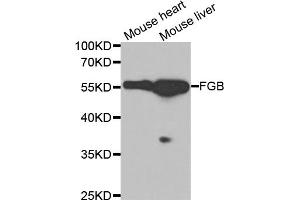 Western blot analysis of extracts of various cell lines, using FGB antibody. (Fibrinogen beta Chain anticorps)