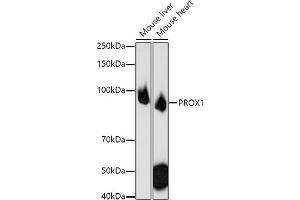 Western blot analysis of extracts of various cell lines, using PROX1 antibody (ABIN6132519, ABIN6146252, ABIN6146253 and ABIN6216882) at 1:1000 dilution. (PROX1 anticorps  (AA 1-300))