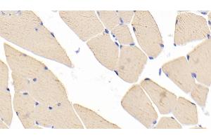Detection of MYH1 in Mouse Skeletal muscle Tissue using Polyclonal Antibody to Myosin Heavy Chain 1 (MYH1) (MYH1 anticorps  (AA 1585-1642))