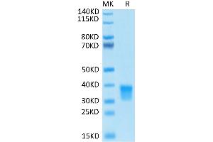 Biotinylated Oncostatin M on Tris-Bis PAGE under reduced conditions.