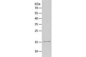 Western Blotting (WB) image for Ubiquitin Specific Peptidase 5 (USP5) (AA 163-291) protein (His tag) (ABIN7125597)