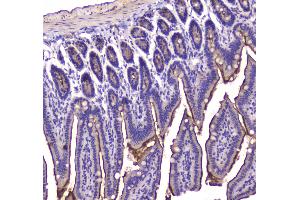 IHC analysis of Cannabinoid Receptor I using anti-Cannabinoid Receptor I antibody .