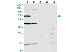 Western blot analysis of Lane 1: RT-4, Lane 2: U-251 MG, Lane 3: Human Plasma, Lane 4: Liver, Lane 5: Tonsil with TMEM87B polyclonal antibody  at 1:250-1:500 dilution. (TMEM87B anticorps)