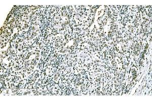 IHC analysis of ADAR1/ADAR using anti-ADAR1/ADAR antibody (ABIN7598956). (ADAR anticorps  (AA 1-1152))