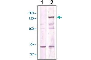 The cell lysate derived from NIH/3T3 was immunoprecipitated by ROCK2 polyclonal antibody , then immunoprobed by the same antibody at 1 : 500 (lane 2). (ROCK2 anticorps  (AA 250-350))
