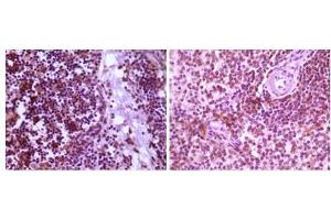Immunohistochemical analysis of paraffin-embedded human thymoma tissue (left) and spleen tissue (right), showing cytoplasmic localization using MAP2K4 antibody with DAB staining. (MAP2K4 anticorps)