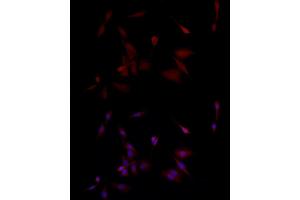 Immunofluorescence analysis of PC-12 cells using PGP9.
