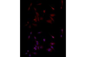 Immunofluorescence analysis of PC-12 cells using PGP9. (UCHL1 anticorps  (AA 1-220))