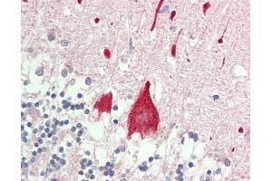 Human Brain, Cerebellum: Formalin-Fixed, Paraffin-Embedded (FFPE).